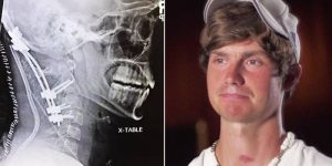 VIDEO Decapitarea internă: Omul care a supraviețuit unei traume extreme